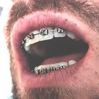 braces Profile Picture