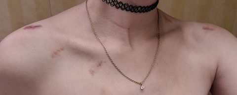 vulpix @vulpixeds cover picture